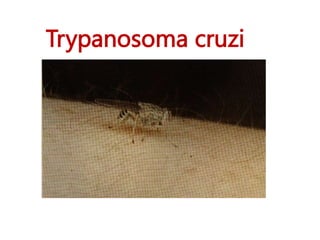 Trypanosoma cruzi 
 