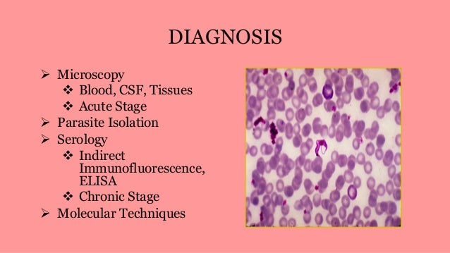 Chagas Disease (American Trypanosomiasis)