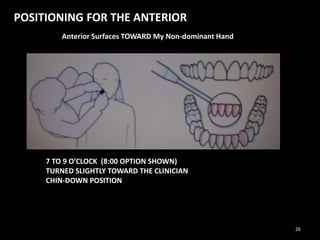 POSITIONING FOR THE ANTERIOR
Anterior Surfaces TOWARD My Non-dominant Hand
7 TO 9 O’CLOCK (8:00 OPTION SHOWN)
TURNED SLIGHTLY TOWARD THE CLINICIAN
CHIN-DOWN POSITION
26
 