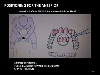 POSITIONING FOR THE ANTERIOR
Anterior Surfaces AWAY From My Non-dominant Hand
12 O’CLOCK POSITION
TURNED SLIGHTLY TOWARD THE CLINICIAN
CHIN-UP POSITION
29
 