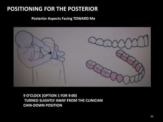 POSITIONING FOR THE POSTERIOR
Posterior Aspects Facing TOWARD Me
9 O’CLOCK (OPTION 1 FOR 9:00)
TURNED SLIGHTLY AWAY FROM THE CLINICIAN
CHIN-DOWN POSITION
30
 