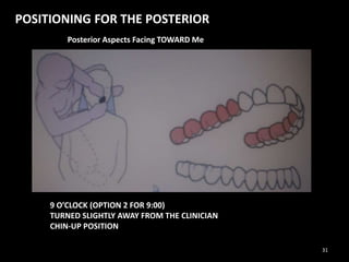 POSITIONING FOR THE POSTERIOR
Posterior Aspects Facing TOWARD Me
9 O’CLOCK (OPTION 2 FOR 9:00)
TURNED SLIGHTLY AWAY FROM THE CLINICIAN
CHIN-UP POSITION
31
 