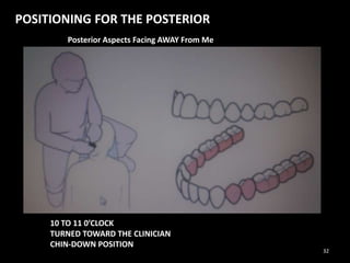 POSITIONING FOR THE POSTERIOR
Posterior Aspects Facing AWAY From Me
10 TO 11 0’CLOCK
TURNED TOWARD THE CLINICIAN
CHIN-DOWN POSITION
32
 