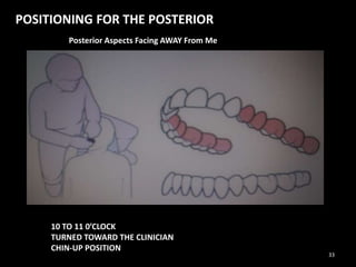 POSITIONING FOR THE POSTERIOR
Posterior Aspects Facing AWAY From Me
10 TO 11 0’CLOCK
TURNED TOWARD THE CLINICIAN
CHIN-UP POSITION
33
 