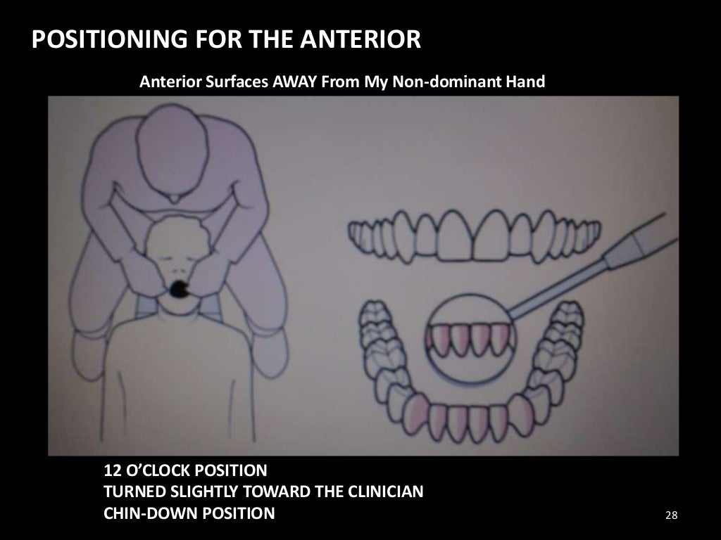 dental Chair position