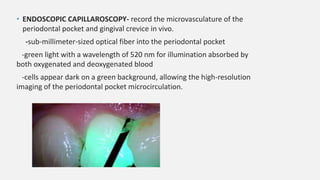 chairside diagnostic aid for diagnosing periodontitis | PPTX