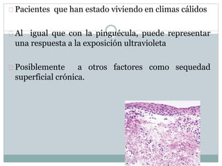 Pacientes que han estado viviendo en climas cálidos
Al igual que con la pinguécula, puede representar
una respuesta a la exposición ultravioleta
Posiblemente a otros factores como sequedad
superficial crónica.
 