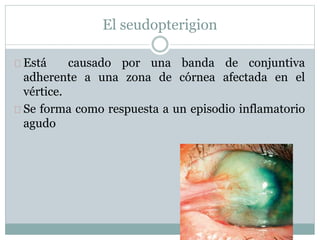 El seudopterigion
Está causado por una banda de conjuntiva
adherente a una zona de córnea afectada en el
vértice.
Se forma como respuesta a un episodio inflamatorio
agudo
 