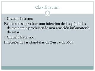 Orzuelo Interno:
Es cuando se produce una infección de las glándulas
de meibomio produciendo una reacción inflamatoria
de estas.
Orzuelo Externo:
Infección de las glándulas de Zeiss y de Moll.
Clasificación
 