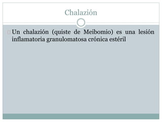 Chalazión
Un chalazión (quiste de Meibomio) es una lesión
inflamatoria granulomatosa crónica estéril
 
