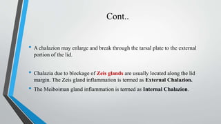 Cont..
• A chalazion may enlarge and break through the tarsal plate to the external
portion of the lid.
• Chalazia due to blockage of Zeis glands are usually located along the lid
margin. The Zeis gland inflammation is termed as External Chalazion.
• The Meiboiman gland inflammation is termed as Internal Chalazion.
 