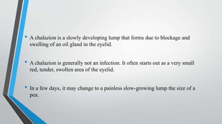 • A chalazion is a slowly developing lump that forms due to blockage and
swelling of an oil gland in the eyelid.
• A chalazion is generally not an infection. It often starts out as a very small
red, tender, swollen area of the eyelid.
• In a few days, it may change to a painless slow-growing lump the size of a
pea.
 