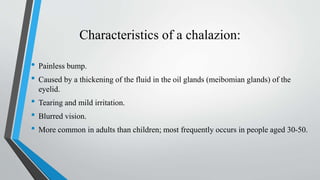 Characteristics of a chalazion:
• Painless bump.
• Caused by a thickening of the fluid in the oil glands (meibomian glands) of the
eyelid.
• Tearing and mild irritation.
• Blurred vision.
• More common in adults than children; most frequently occurs in people aged 30-50.
 