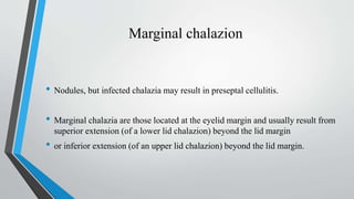 Marginal chalazion
• Nodules, but infected chalazia may result in preseptal cellulitis.
• Marginal chalazia are those located at the eyelid margin and usually result from
superior extension (of a lower lid chalazion) beyond the lid margin
• or inferior extension (of an upper lid chalazion) beyond the lid margin.
 