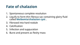 Fate of chalazion
1. Spontaneous complete resolution
2. Liquify to form thin fibrous sac containing glairy fluid
called Meibomia/chalazion cyst .
3. Fibrosed into hard nodule
4. Calcification
5. Infection and suppuration
6. Burst and present as fleshy mass
 