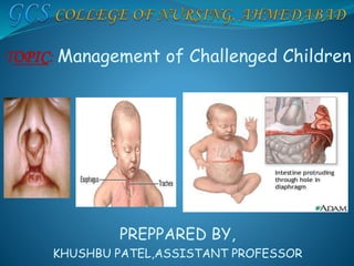 TOPIC: Management of Challenged Children
PREPPARED BY,
KHUSHBU PATEL,ASSISTANT PROFESSOR
 