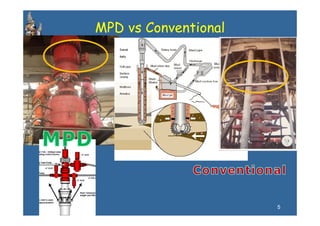 MPD vs Conventional




                      5
 