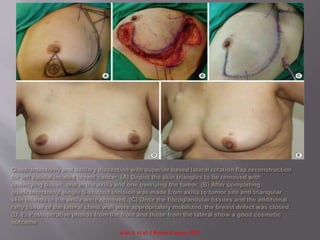 Kim J. et al. J Breast Cancer. 2012
 