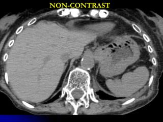 NON-CONTRAST
 