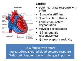 Poor Cardiac Function Challenges in rehabilitation of the elderly patient | PPTX