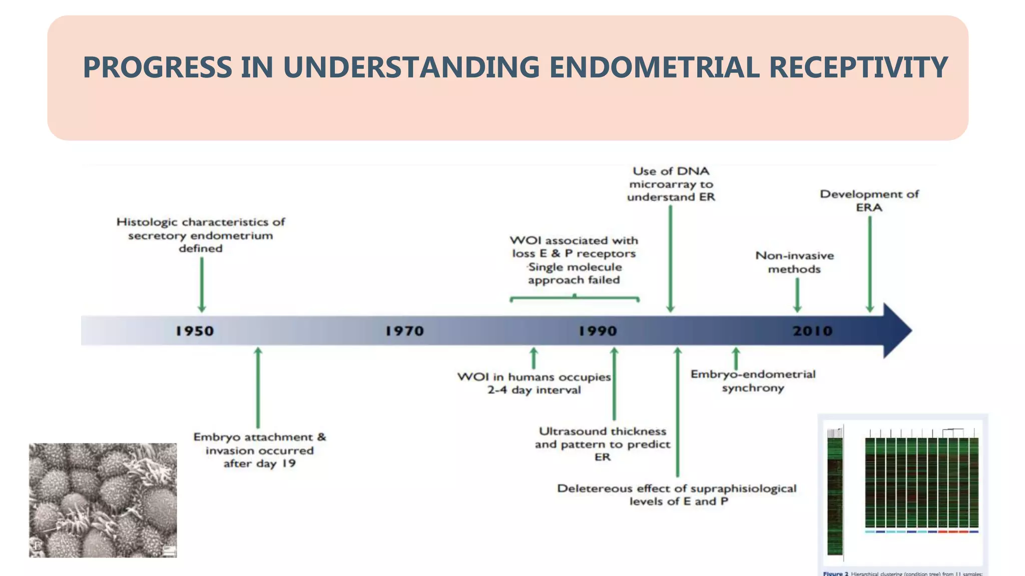 PROGRESS IN UNDERSTANDING ENDOMETRIAL RECEPTIVITY