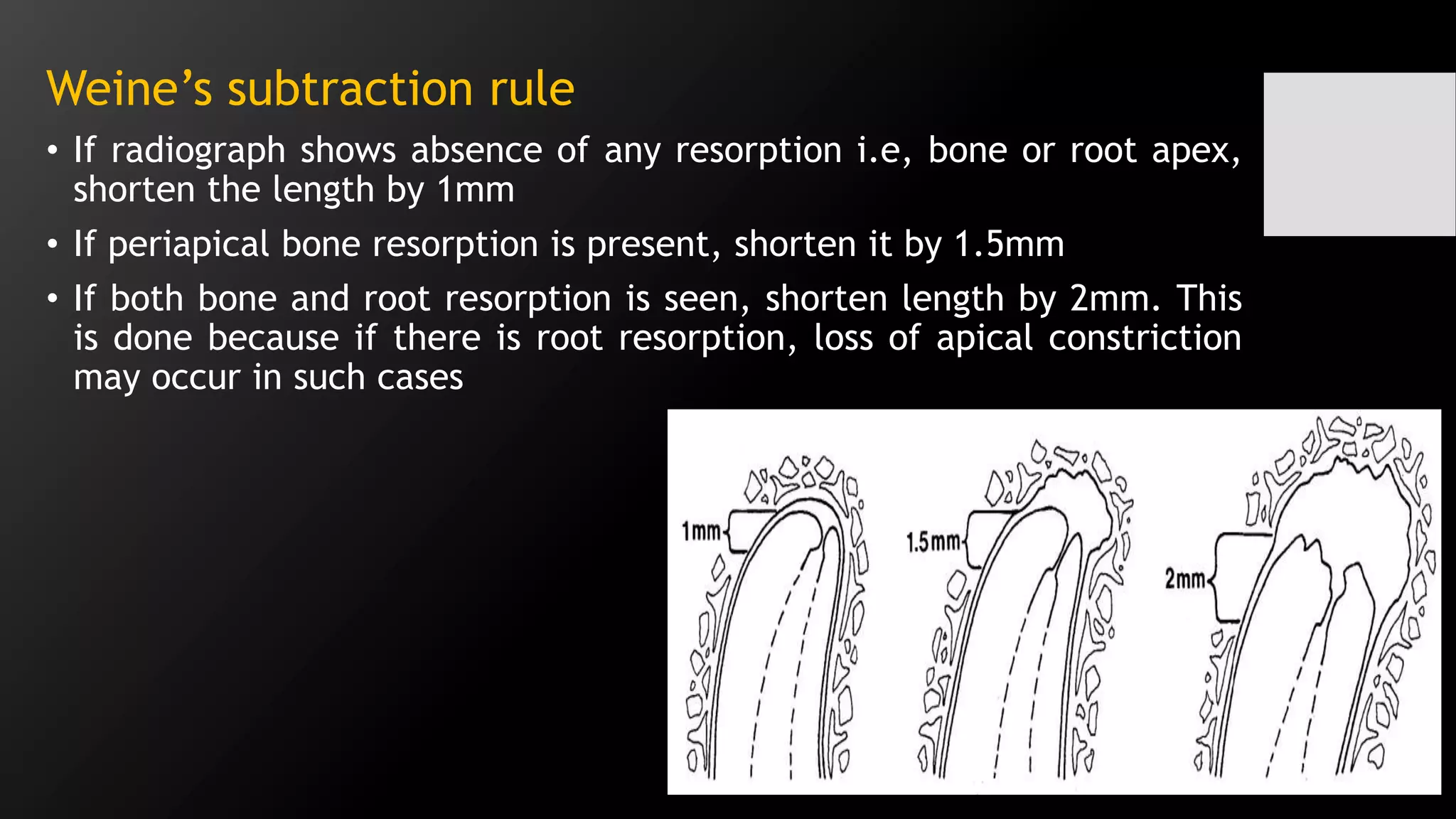 Challenges in working length determination | PPTX
