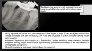 Challenges in working length determination | PPTX