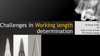 Challenges in Working length
determination
By
Dr.Anoop.V.Nair
PG
Dept of Cons & Endo
KVG Dental College
 