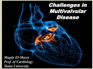 Challenges in
Multivalvular
Disease
Magdy El-Masry
Prof. of Cardiology
Tanta University
 