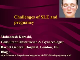 Challenges of SLE and
pregnancy
Mahantesh Karoshi,
Consultant Obstetrician & Gynaecologist
Barnet General Hospital, London, UK
Blog :
http://labourwardexperiences.blogspot.co.uk/2013/06/sleinpregnancy.html
 