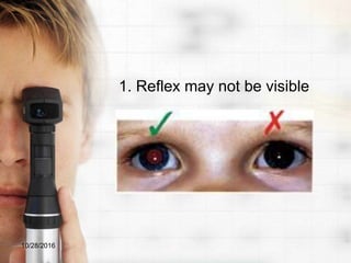 1. Reflex may not be visible
10/28/2016
 