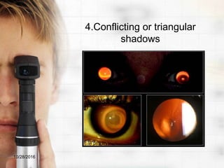 4.Conflicting or triangular
shadows
10/28/2016
 