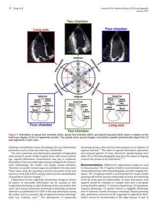 tethering or overall heart motion. Accordingly, the use of deformation
parameters, such as strain and strain rate, is preferable.
The most commonly used deformation parameter is longitudinal
strain during LV systole. Similar to global strain, with current technol-
ogy, regional deformation measurements may vary in amplitude,
depending on the myocardial region being investigated, the measure-
ment methodology, the vendor, and sample volume deﬁnition.
Therefore, no speciﬁc normal ranges are provided in this document.
These values await the upcoming consensus document of the joint
task force of the ASE, EACVI, and the industry for the standardization
of quantitative function imaging.23,25
Independent of strain magnitude, characteristic changes in tempo-
ral pattern of myocardial deformation can be assessed as well.
Longitudinal shortening or radial thickening of the myocardium after
aortic valve closure (postsystolic shortening or thickening, sometimes
referred to as tardokinesis) of 20% of the total deformation during
the cardiac cycle is a consistent sign of regional functional inhomoge-
neity (e.g., ischemia, scar).44
The development of postsystolic
shortening during a stress test has been proposed as an indicator of
regional ischemia.49
The value of regional deformation parameters
and temporal patterns of strain derived by speckle-tracking from
either 2D or 3D echocardiographic data sets is the subject of ongoing
research and remains to be determined.50,51
Recommendations. Different LV segmentation models are used
in clinical practice. The 17-segment model is recommended to assess
myocardial perfusion with echocardiography and other imaging tech-
niques. The 16-segment model is recommended for routine studies
assessing wall motion, because endocardial excursion and thickening
of the tip of the apex are imperceptible. To assess wall motion, each
segment should be evaluated in multiple views and a four-grade
scoring should be applied: (1) normal or hyperkinetic, (2) hypokinetic
(reduced thickening), (3) akinetic (absent or negligible thickening),
and (4) dyskinetic (systolic thinning or stretching). Despite promising
data, quantitative assessment of the magnitude of regional LV defor-
mation cannot be recommended at this stage because of lack of
Figure 4 Orientation of apical four-chamber (A4C), apical two-chamber (A2C), and apical long-axis (ALX) views in relation to the
bull’s-eye display of the LV segments (center). Top panels show actual images, and bottom panels schematically depict the LV
wall segments in each view.
12 Lang et al Journal of the American Society of Echocardiography
January 2015
 
