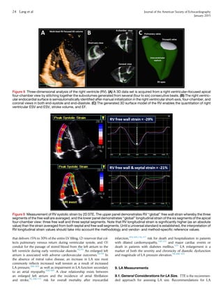 that delivers 15% to 30% of the entire LV ﬁlling, (2) reservoir that col-
lects pulmonary venous return during ventricular systole, and (3)
conduit for the passage of stored blood from the left atrium to the
left ventricle during early ventricular diastole.92,93
An enlarged left
atrium is associated with adverse cardiovascular outcomes.94-99
In
the absence of mitral valve disease, an increase in LA size most
commonly reﬂects increased wall tension as a result of increased
LA pressure,100-103
as well as impairment in LA function secondary
to an atrial myopathy.104,105
A clear relationship exists between
an enlarged left atrium and the incidence of atrial ﬁbrillation
and stroke,92,106-115
risk for overall mortality after myocardial
infarction,104,105,116,117
risk for death and hospitalization in patients
with dilated cardiomyopathy,118-122
and major cardiac events or
death in patients with diabetes mellitus.123
LA enlargement is a
marker of both the severity and chronicity of diastolic dysfunction
and magnitude of LA pressure elevation.98,100-103
9. LA Measurements
9.1. General Considerations for LA Size. TTE is the recommen-
ded approach for assessing LA size. Recommendations for LA
Figure 9 Measurement of RV systolic strain by 2D STE. The upper panel demonstrates RV ‘‘global’’ free wall strain whereby the three
segments of the free wall are averaged, and the lower panel demonstrates ‘‘global’’ longitudinal strain of the six segments of the apical
four-chamber view: three free wall and three septal segments. Note that RV longitudinal strain is signiﬁcantly higher (as an absolute
value) than the strain averaged from both septal and free wall segments. Until a universal standard is established, the interpretation of
RV longitudinal strain values should take into account the methodology and vendor- and method-speciﬁc reference values.
Figure 8 Three-dimensional analysis of the right ventricle (RV). (A) A 3D data set is acquired from a right ventricular–focused apical
four-chamber view by stitching together the subvolumes generated from several (four to six) consecutive beats. (B) The right ventric-
ular endocardial surface is semiautomatically identiﬁed after manual initialization in the right ventricular short-axis, four-chamber, and
coronal views in both end-systole and end-diastole. (C) The generated 3D surface model of the RV enables the quantitation of right
ventricular ESV and ESV, stroke volume, and EF.
24 Lang et al Journal of the American Society of Echocardiography
January 2015
 