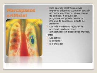 Marcapasos
artificial

Este aparato electrónico envía
impulsos eléctricos cuando el corazón
no puede mantener el ritmo normal
de bombeo. Y según sean
programados, pueden enviar un
impulso de acuerdo al estado del
paciente.
 Los más modernos registran la
actividad cardiaca, y son
almacenados en dispositivos móviles.
Partes:
 Los cables
 El conector
 El generador


 