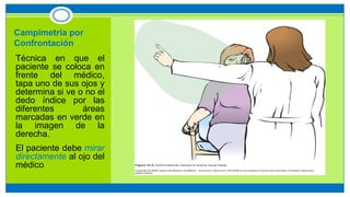 Campimetría por
Confrontación
• Técnica en que el
paciente se coloca en
frente del médico,
tapa uno de sus ojos y
determina si ve o no el
dedo índice por las
diferentes áreas
marcadas en verde en
la imagen de la
derecha.
• El paciente debe mirar
directamente al ojo del
médico
 