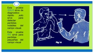 • Esta prueba
SOLO sirve de
diagnostico
rápido ,solo
sirve para
detectar
perdidas
notables del
campo visual.
• Esta prueba
NO sirve para
perdidas
pequeñas del
campo visual
 