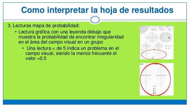 Campimetria_UPMed