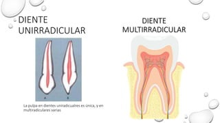 DIENTE
UNIRRADICULAR
DIENTE
MULTIRRADICULAR
La pulpa en dientes uniradicualres es única, y en
multiradiculares varias
 