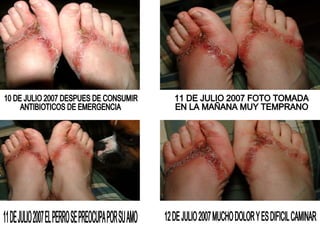 10 DE JULIO 2007 DESPUES DE CONSUMIR ANTIBIOTICOS DE EMERGENCIA 11 DE JULIO 2007 FOTO TOMADA EN LA MAÑANA MUY TEMPRANO 11 DE JULIO 2007 EL PERRO SE PREOCUPA POR SU AMO 12 DE JULIO 2007 MUCHO DOLOR Y ES DIFICIL CAMINAR 