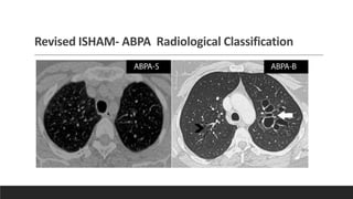 ABPA RADDIOLOGY MEET_DR CHANDAN SHEET.pdf