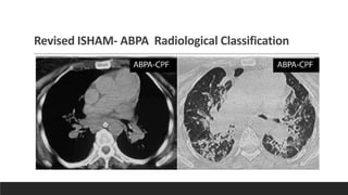 ABPA RADDIOLOGY MEET_DR CHANDAN SHEET.pdf