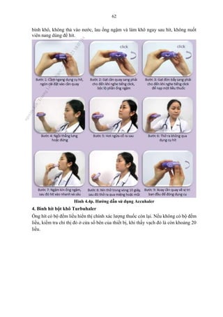 62
bình khô, không thả vào nước, lau ống ngậm và làm khô ngay sau hít, không nuốt
viên nang dùng để hít.
Hình 4.4p. Hướng dẫn sử dụng Accuhaler
4. Bình hít bột khô Turbuhaler
Ống hít có bộ đếm liều hiển thị chính xác lượng thuốc còn lại. Nếu không có bộ đếm
liều, kiểm tra chỉ thị đỏ ở cửa sổ bên của thiết bị, khi thấy vạch đỏ là còn khoảng 20
liều.
n
g
o
c
t
l
v
.
k
c
b
_
T
r
u
o
n
g
L
e
V
a
n
N
g
o
c
_
2
7
/
1
0
/
2
0
2
3
1
8
:
0
7
:
3
4
 