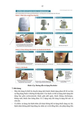65
Hình 4.7p. Hướng dẫn sử dụng Breehaler
7. Khí dung
- Máy khí dung là thiết bị chuyển dung dịch thuốc thành dạng phun để tối ưu hóa
sự lắng đọng thuốc ở đường hô hấp dưới. Các thuốc có thể sử dụng dưới dạng khí
dung bao gồm corticosteroid, thuốc giãn phế quản, thuốc kháng cholinergic,
kháng sinh, thuốc làm loãng đờm. Có 2 dạng máy khí dung là dạng khí nén và
siêu âm.
- Ưu điểm: sử dụng cho bệnh nhân yếu hoặc không thể sử dụng thuốc dạng xịt, hít;
bệnh nhân không phối hợp động tác nhấn xịt và hít đồng thời, cho phép dùng liều
n
g
o
c
t
l
v
.
k
c
b
_
T
r
u
o
n
g
L
e
V
a
n
N
g
o
c
_
2
7
/
1
0
/
2
0
2
3
1
8
:
0
7
:
3
4
 