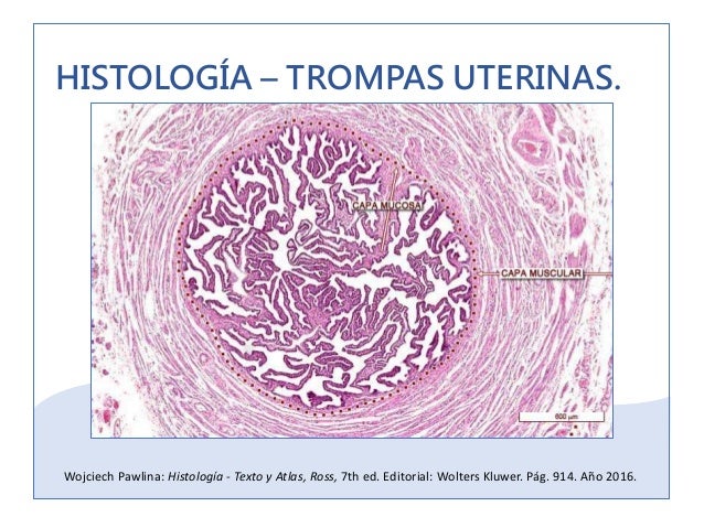 Histologia De Cisto De Trompa De Falopio