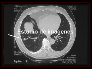 Estudio de imagenes 