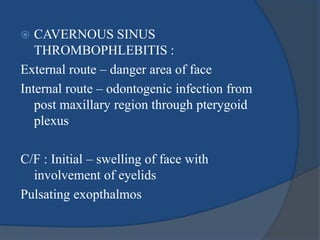  CAVERNOUS SINUS
THROMBOPHLEBITIS :
External route – danger area of face
Internal route – odontogenic infection from
post maxillary region through pterygoid
plexus
C/F : Initial – swelling of face with
involvement of eyelids
Pulsating exopthalmos
 