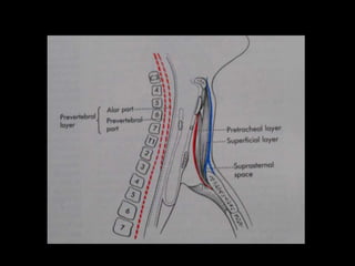 Head and Neck Infections