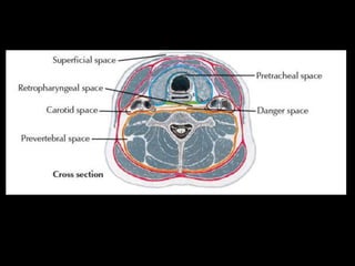 Head and Neck Infections