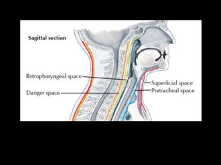 Head and Neck Infections